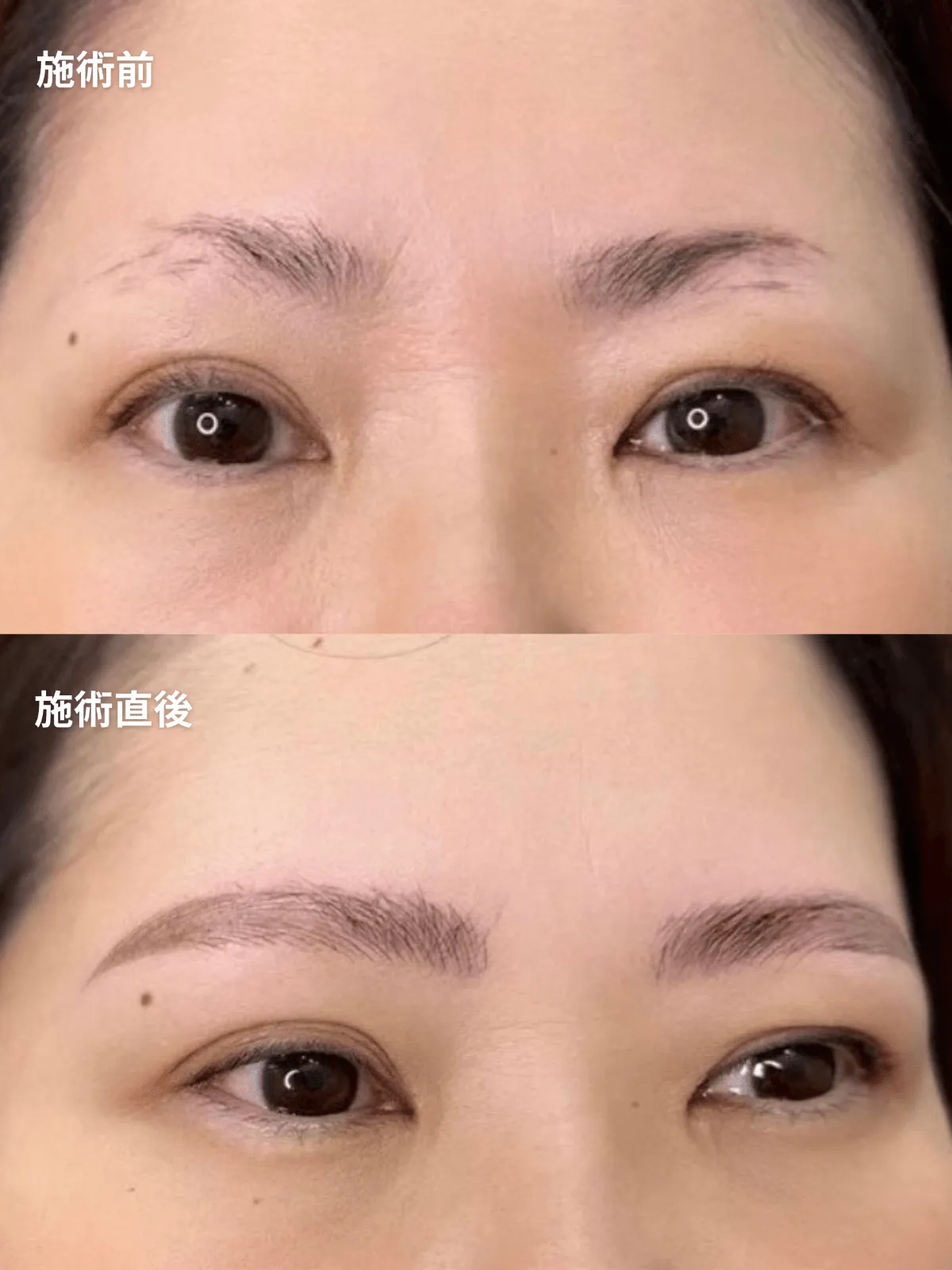 症例11