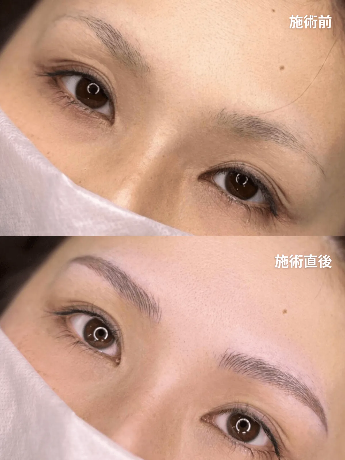 症例12