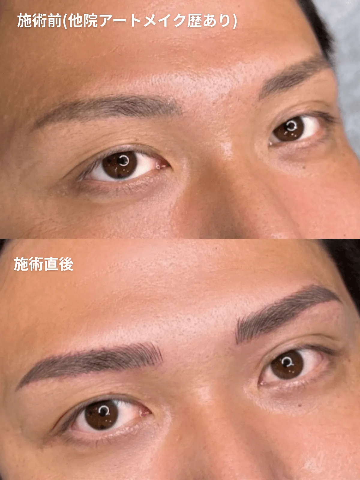 症例14