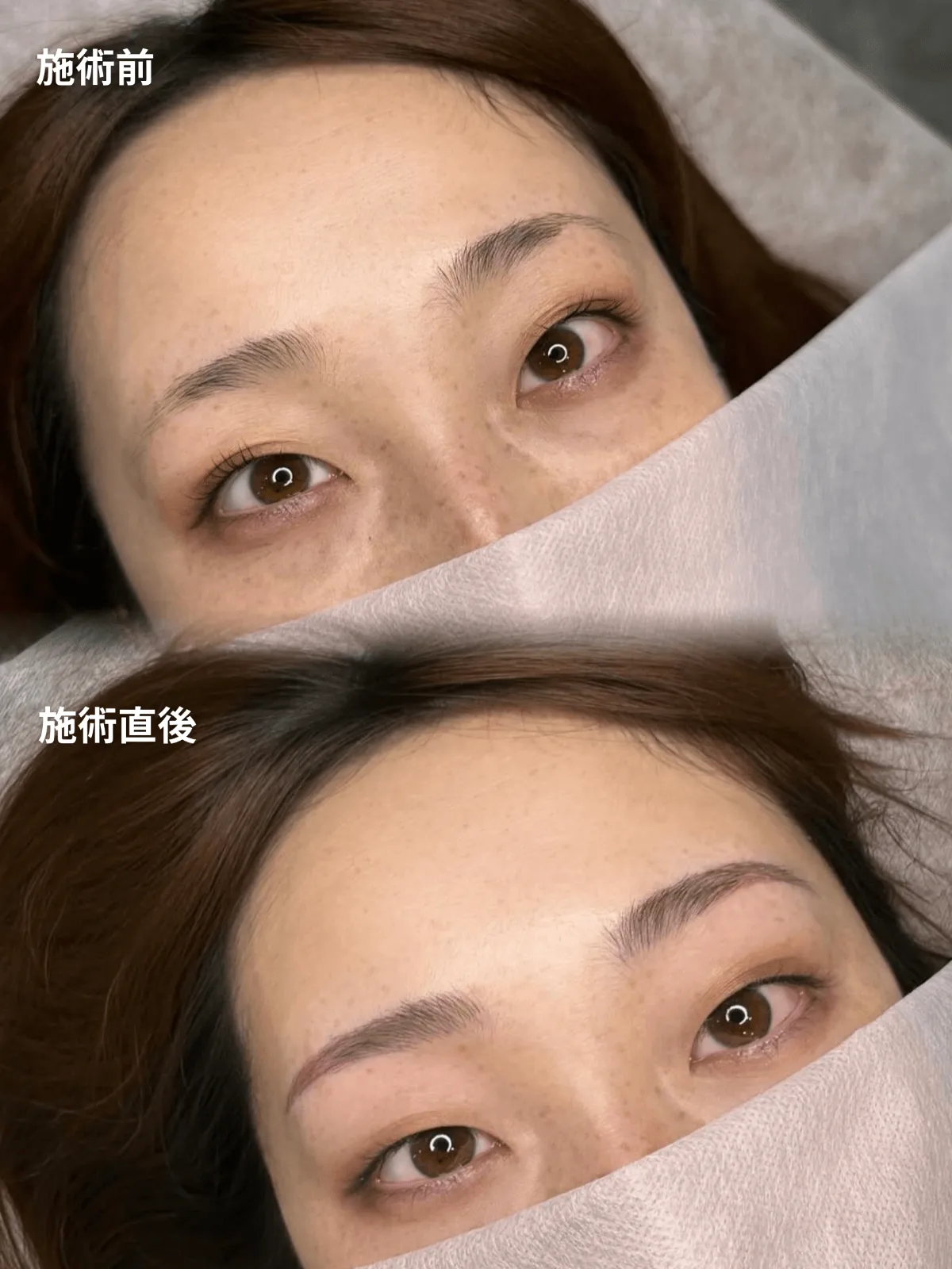 症例15