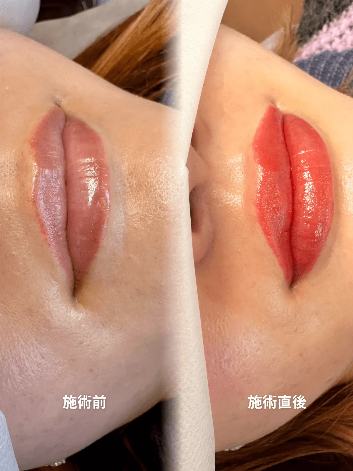 症例20