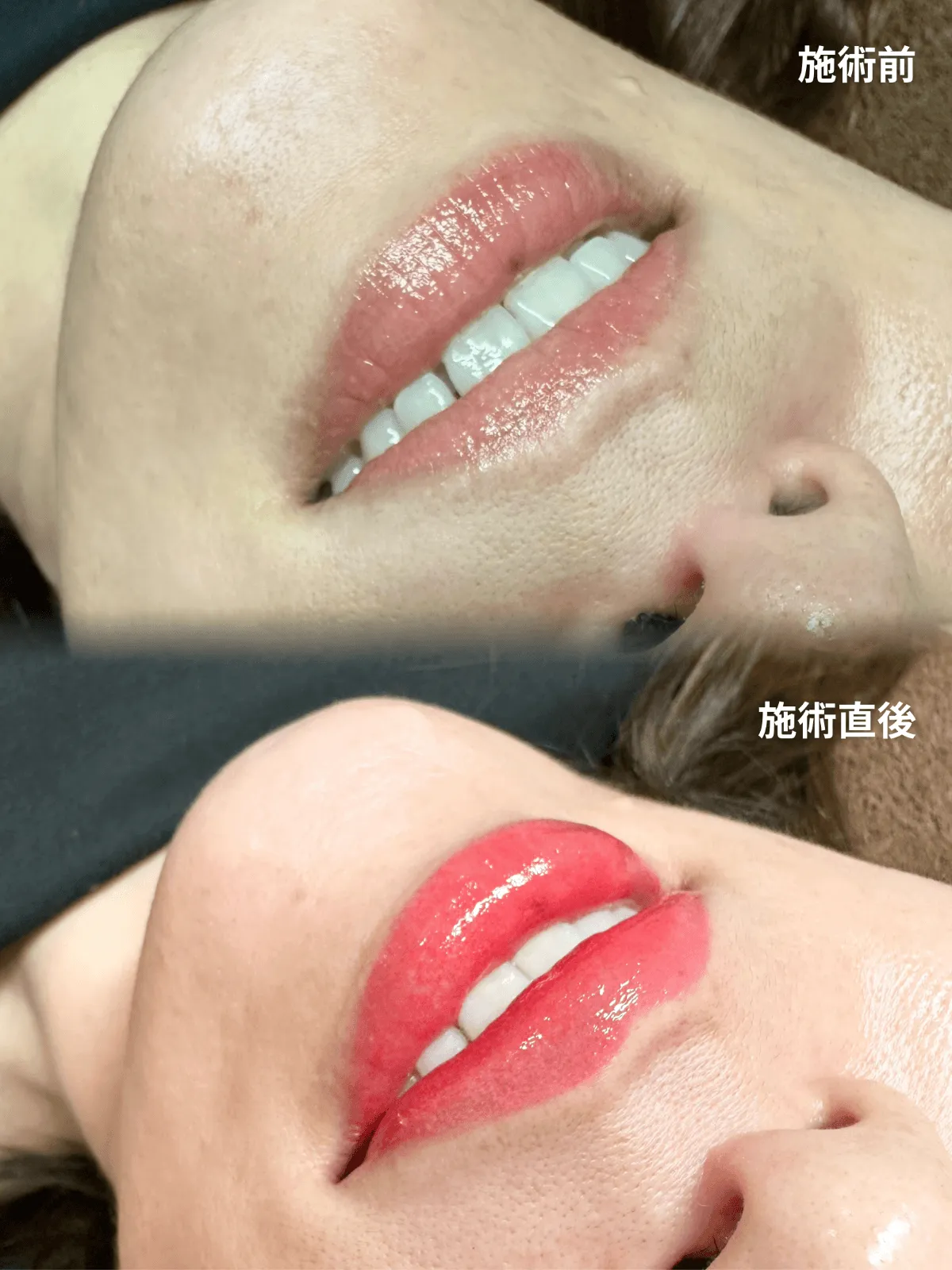症例21