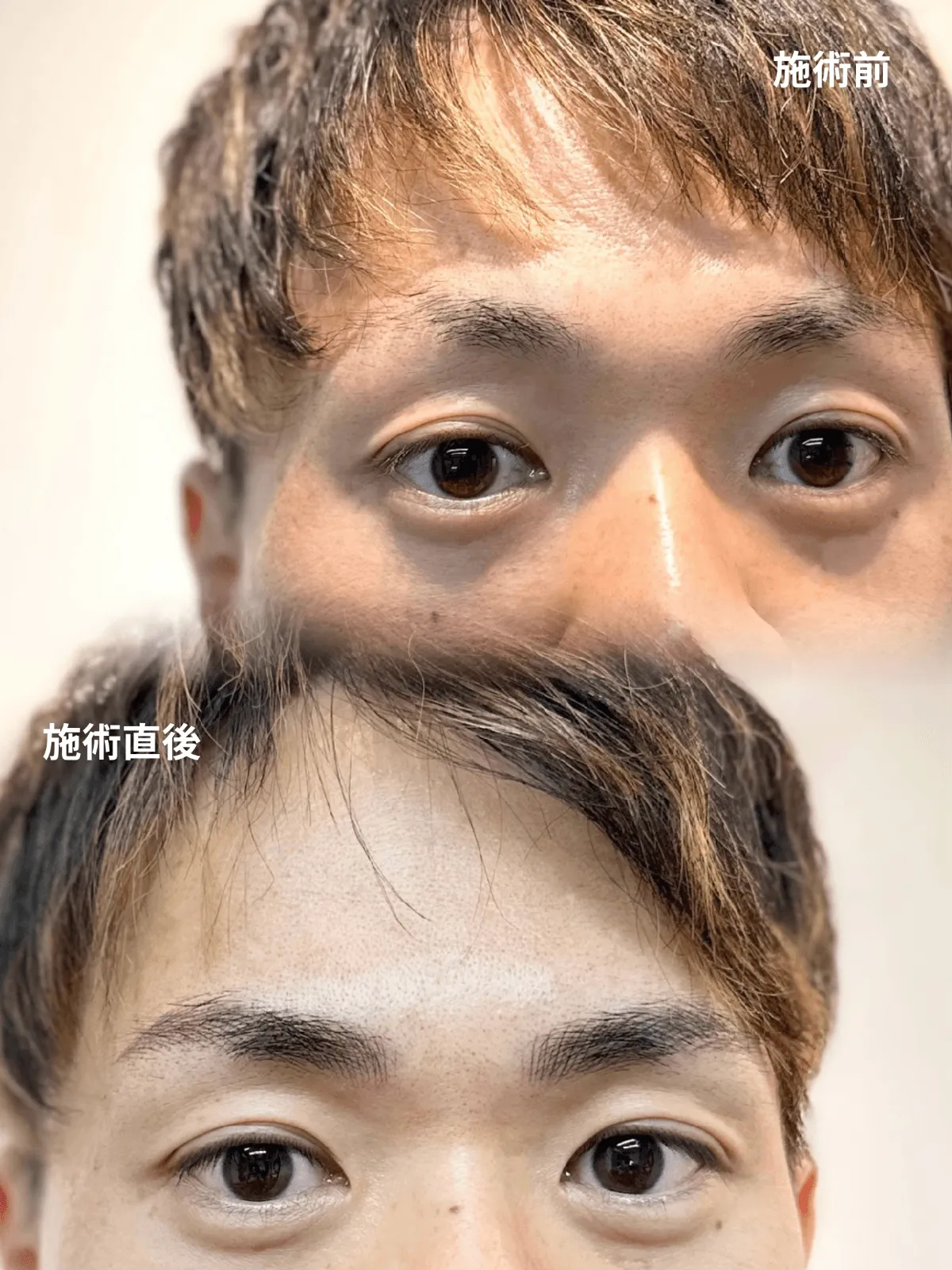 症例9