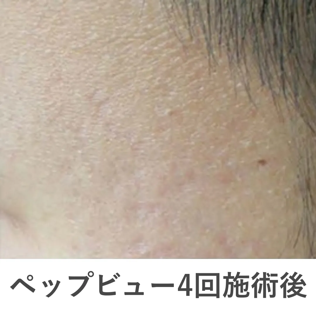 caresys_case1_after