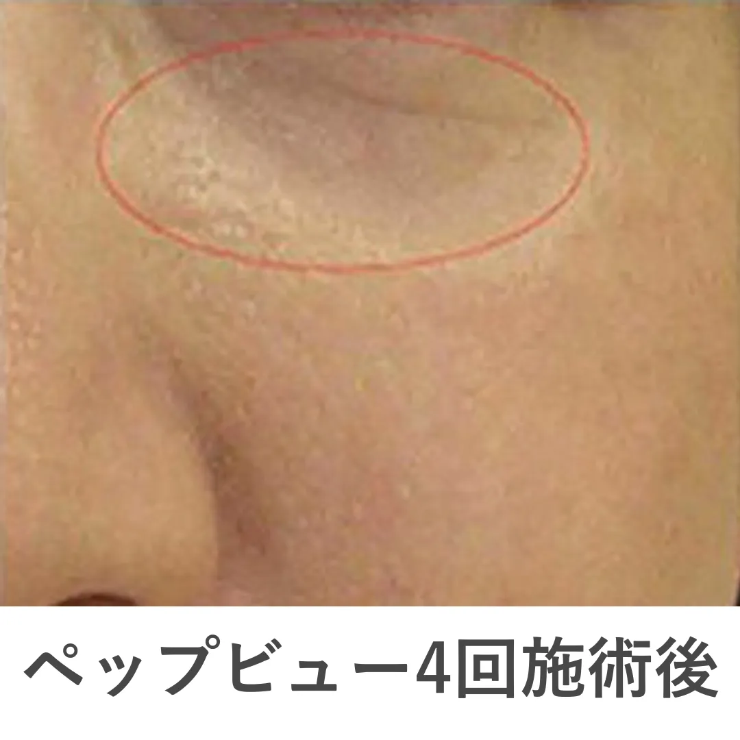 caresys_case2_after