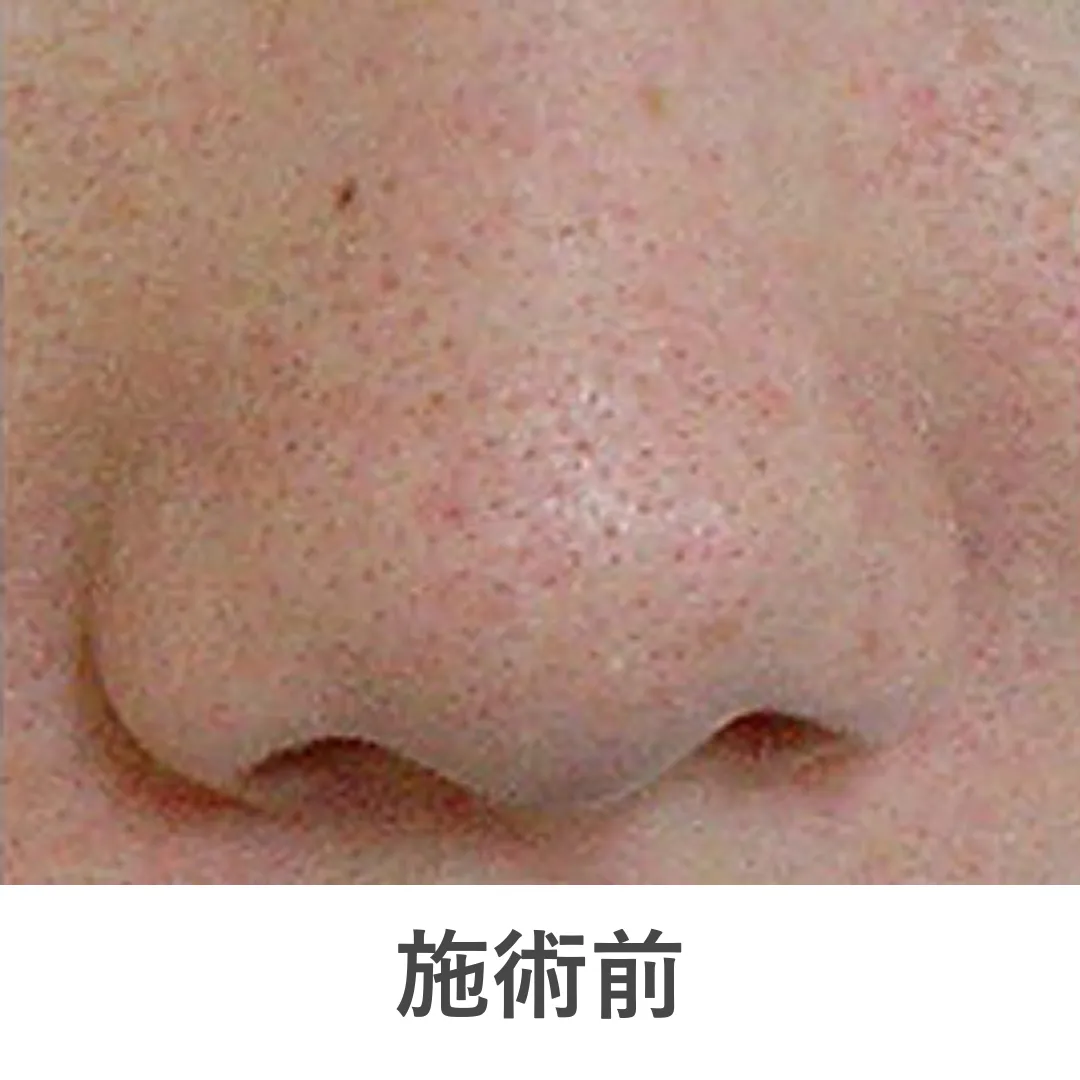 caresys_case3_before