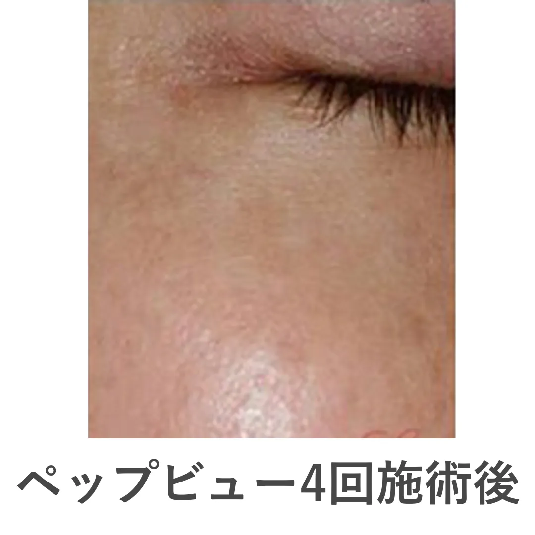 caresys_case4_after