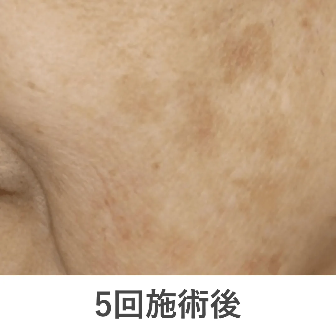 case1_after