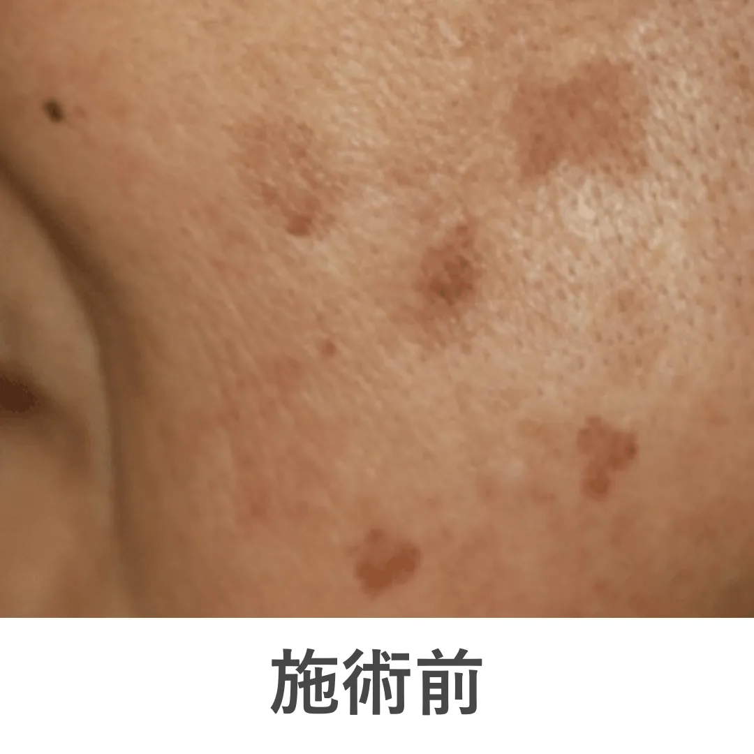 case1_before