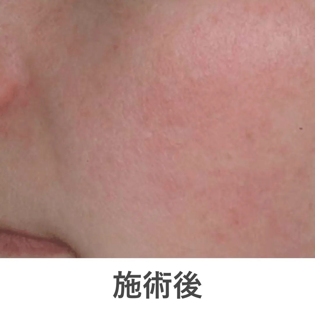 case2_after
