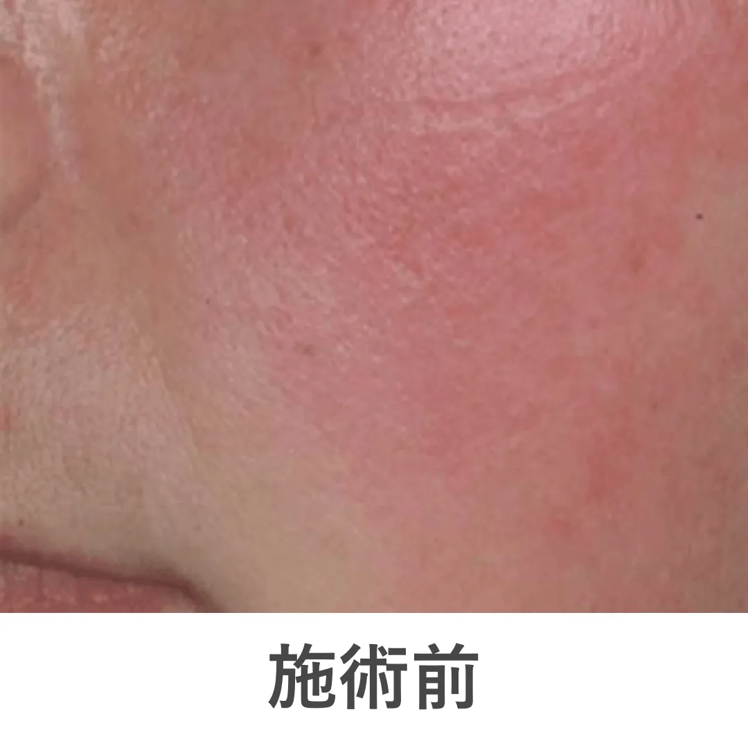 case2_before