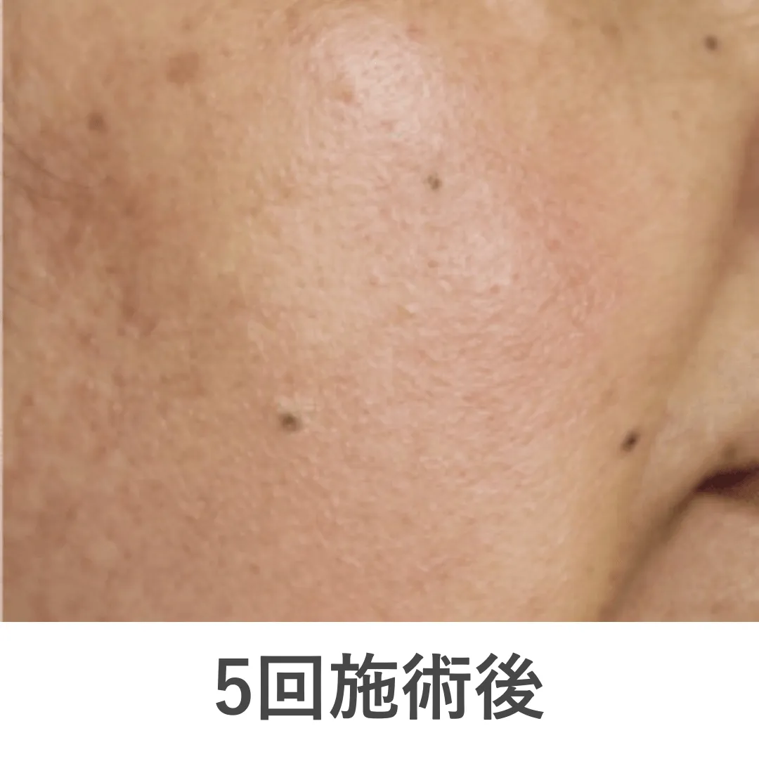 case4_after