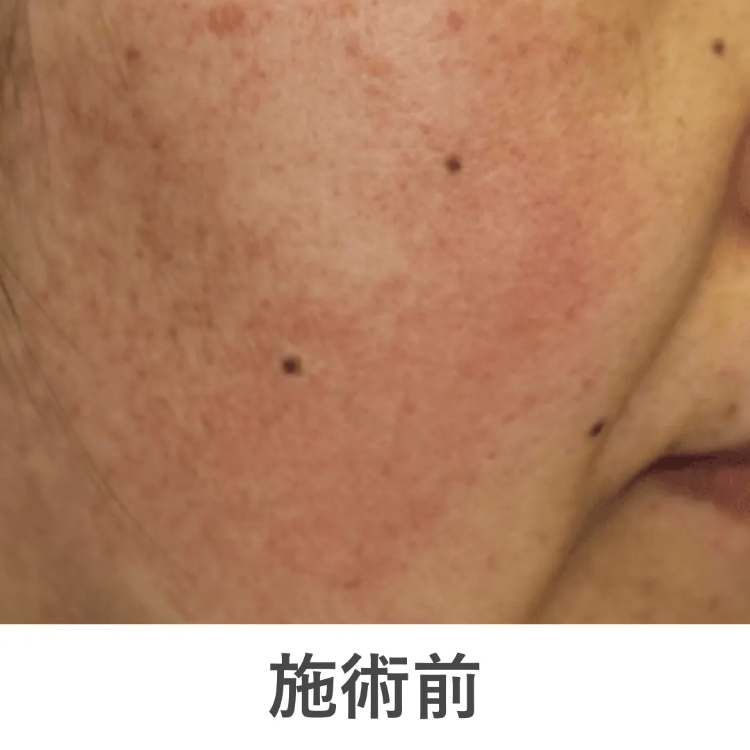 case4_before