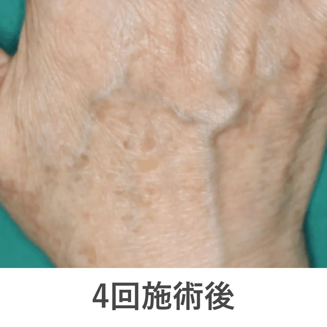 case5_after