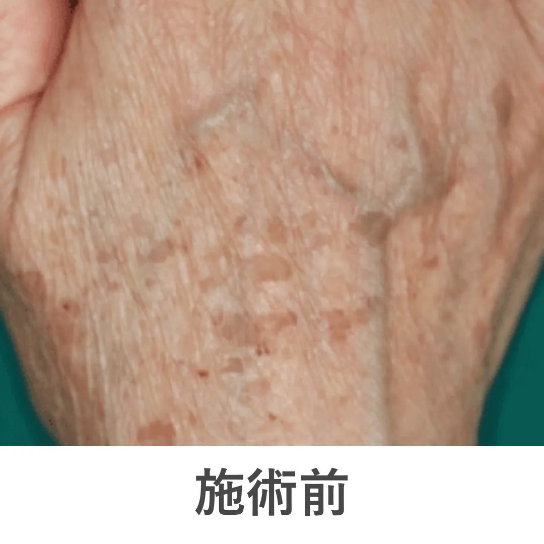 case5_before