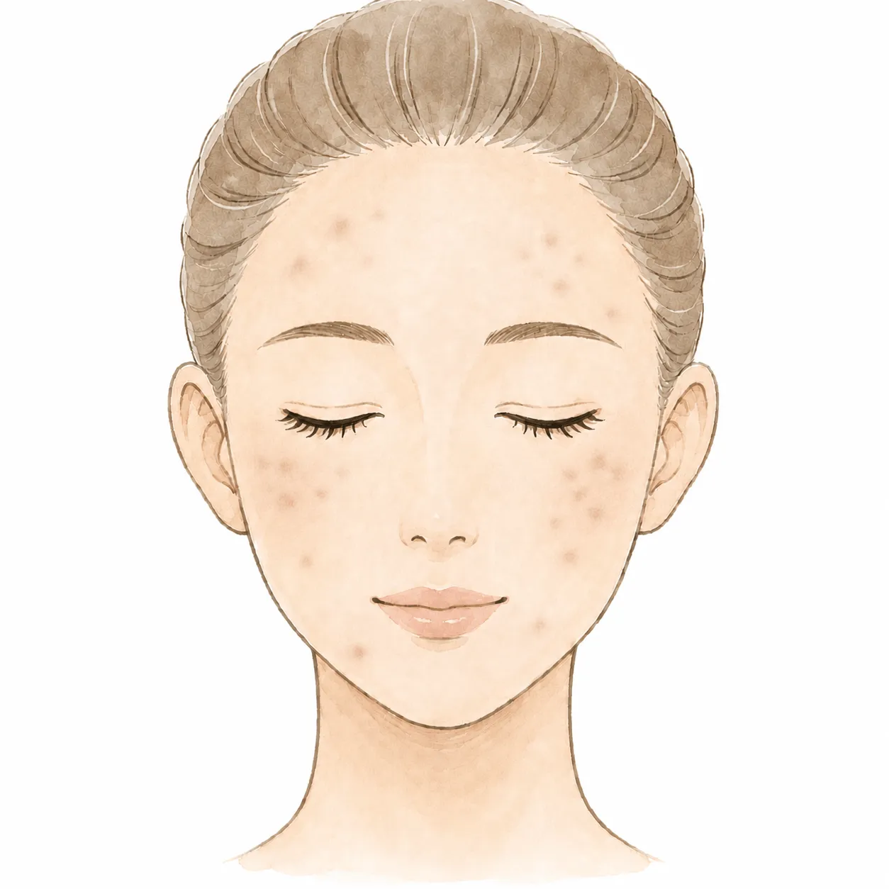 concern_acne_scar1