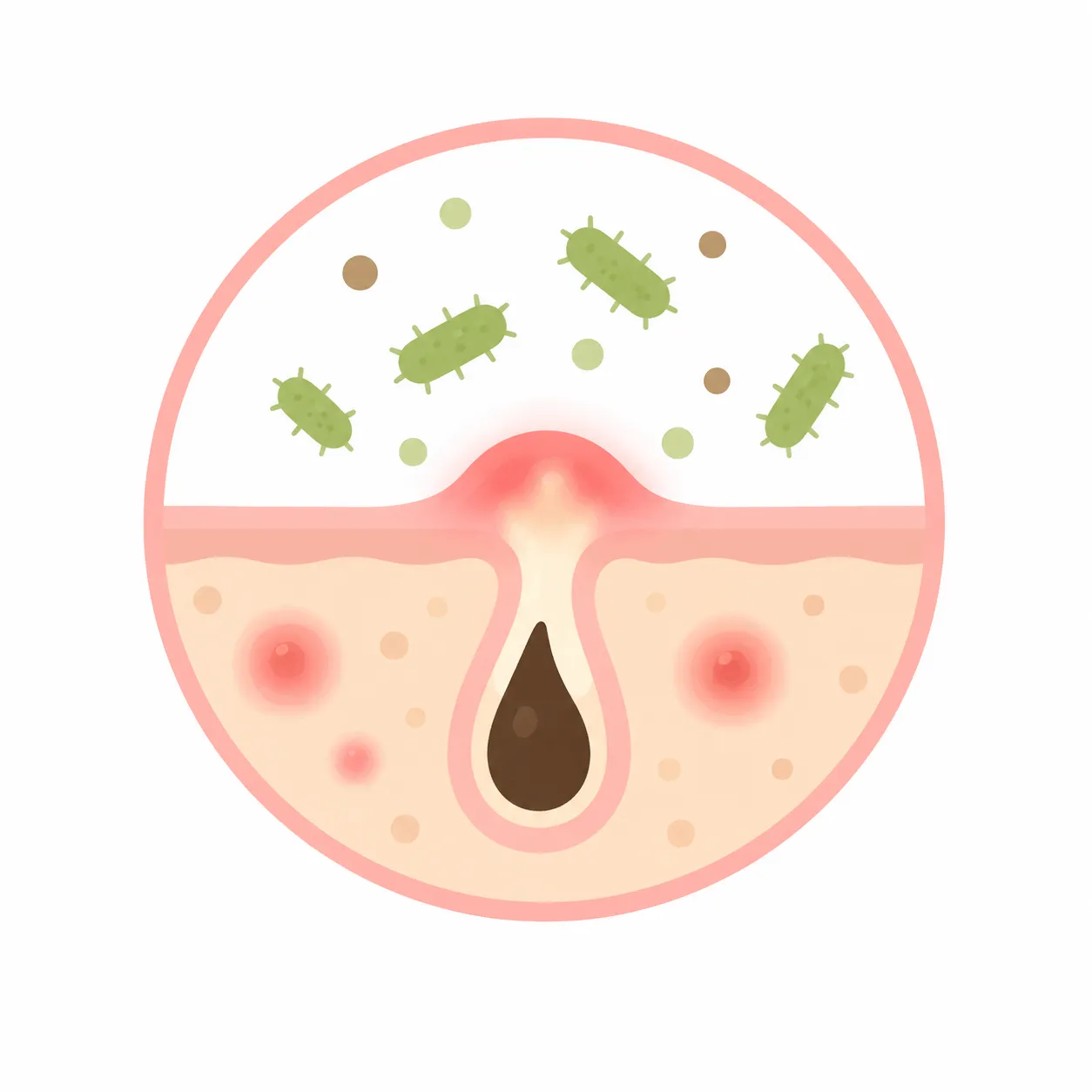 concern_pores_blackhead