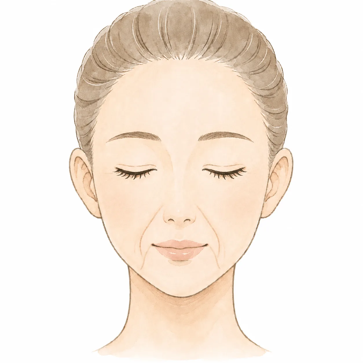 concern_wrinkles_type4