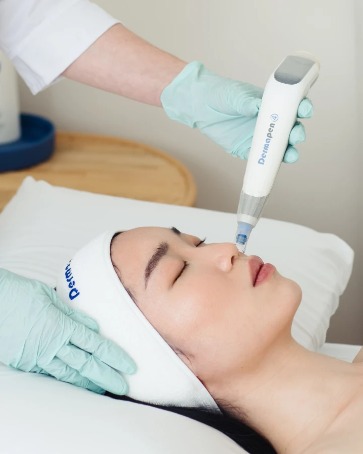 dermapen1